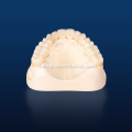 3d multilayer zirconia para sa mga restorasyon ng ngipin